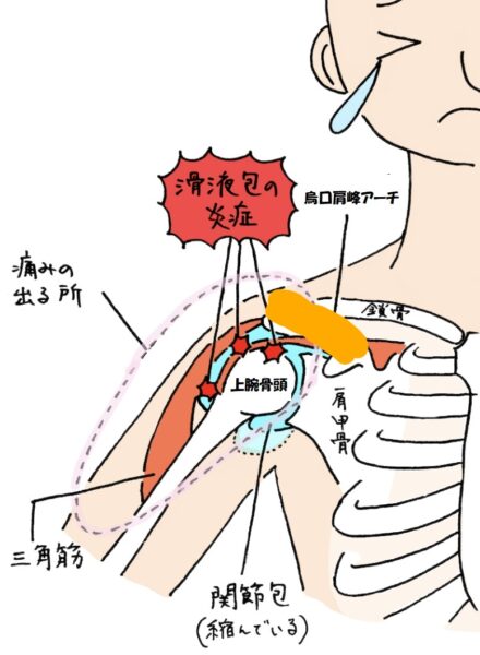 肩関節周囲炎の解剖学的説明