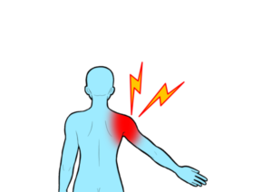 青い色の人の右肩が赤くなっている
