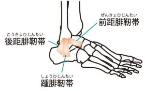 足関節の骨格と「前距腓靭帯」「後距腓靭帯」「踵腓靭帯」の文字