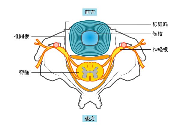 腰椎（椎間板・髄核・繊維輪・脊髄・神経根）を上から見たイラスト