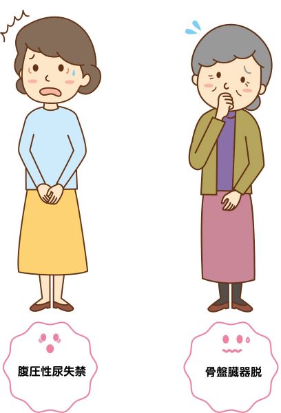 腹圧性尿失禁と臓器脱に悩む二人の中高年女性
