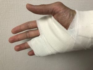 右手の薬指と小指、手首に巻かれた包帯