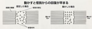患部を動かすと怪我の回復が早まる理由