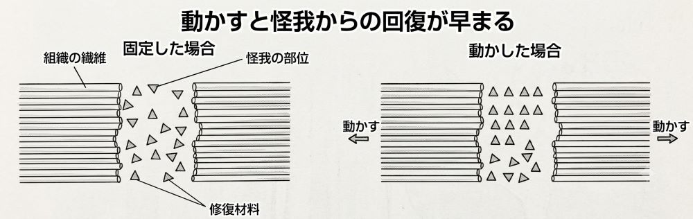 患部を動かすと怪我の回復が早まる理由