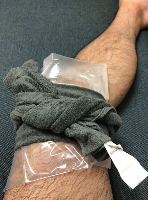 氷水の入ったフリーザーバッグを膝の上に置いてタオルで巻いている