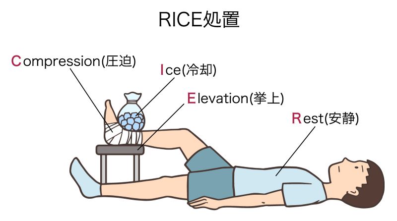 RICE処置(Rest、Ice、Compression、
Elevation)